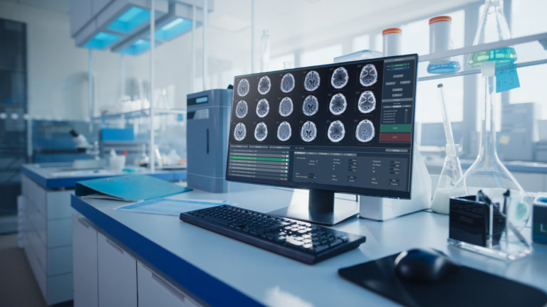 brain injury scans on computer screen